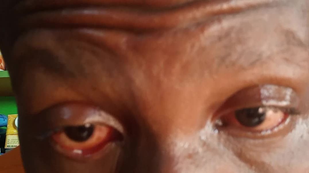 ⁣Eyes witness part 2