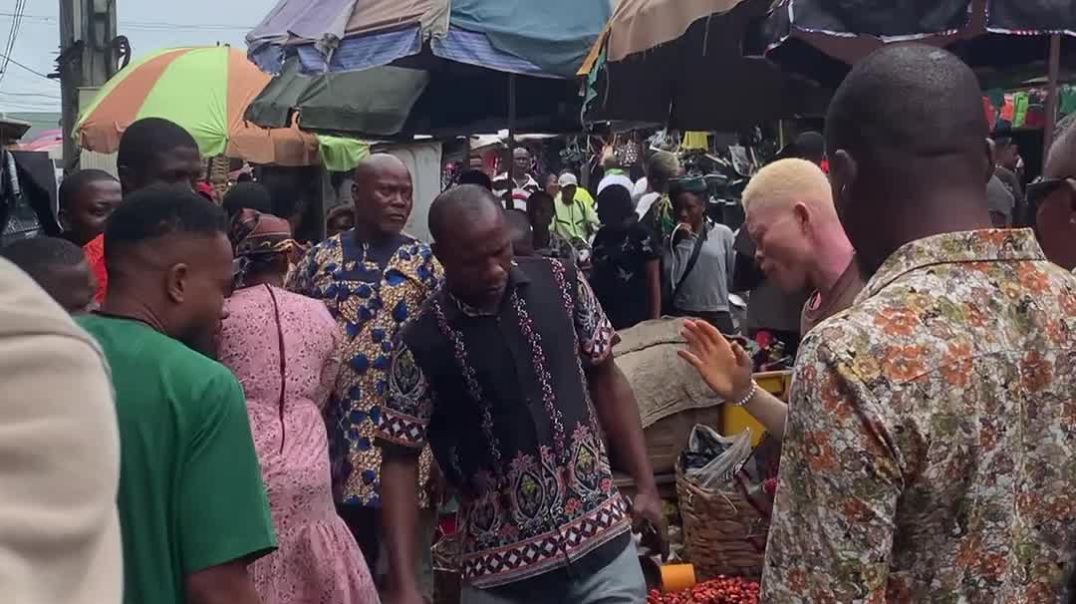 White man wan commot person teeth